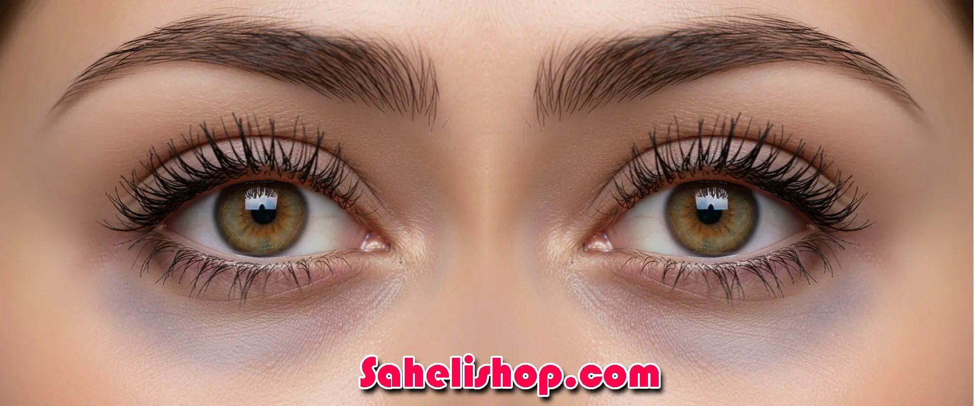 Periorbital dark circles under eyes